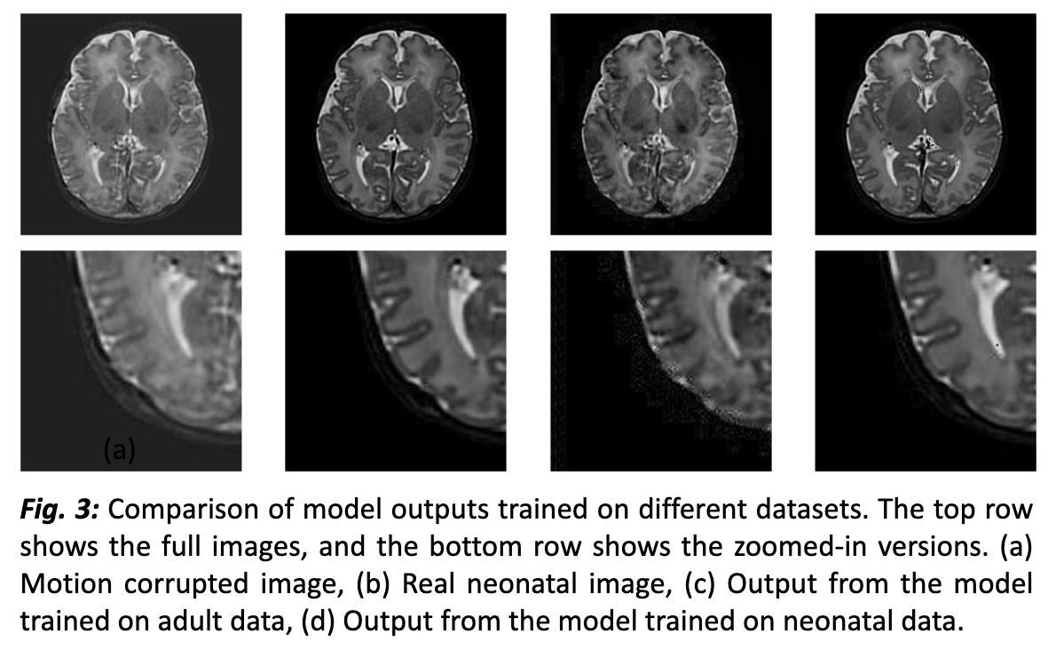 brain-mri.png