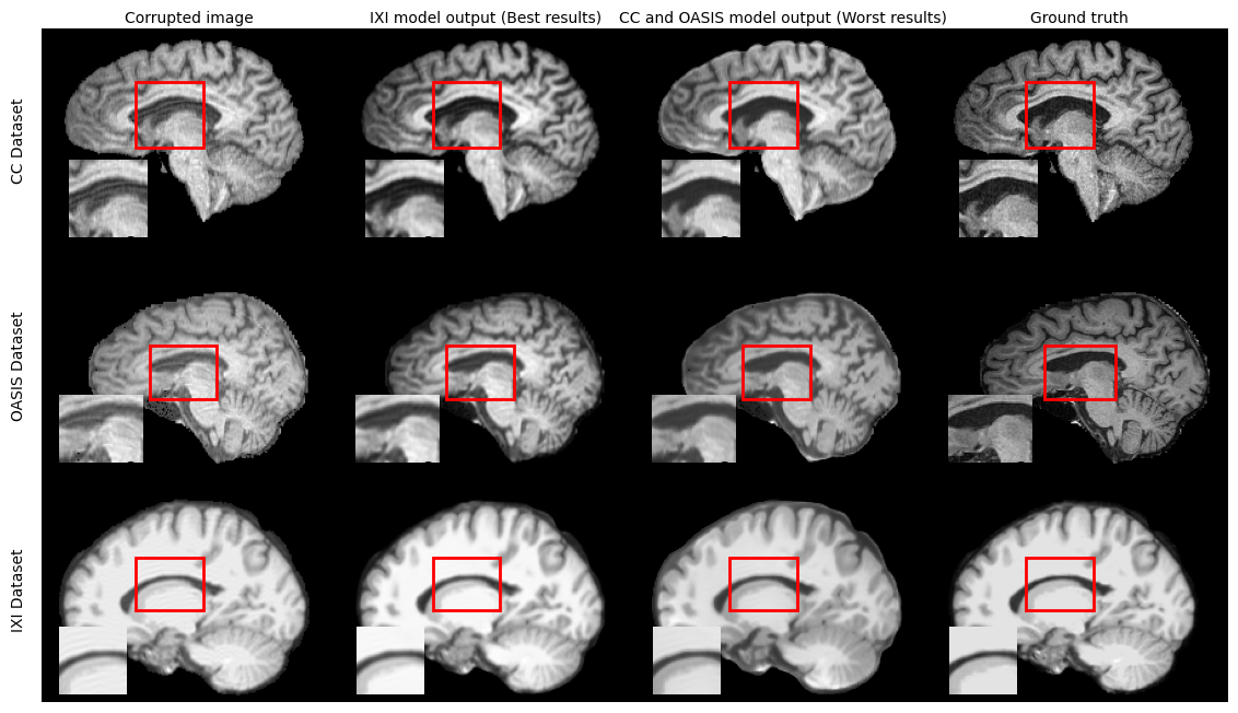 motion-mri-rime.png